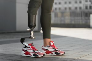 kaki prostetik